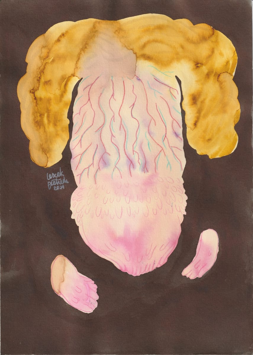 penis-with-pearly-penile-papules-4-2021-nsfw